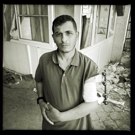 A patient in front of al-Amal hospital