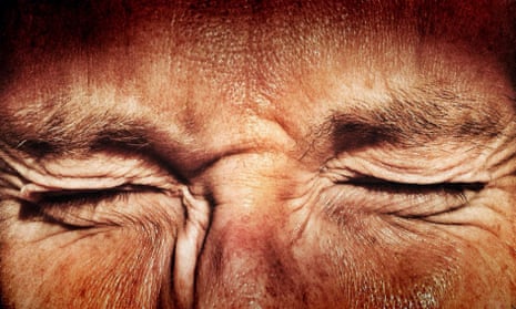 Wrinkled skin on face