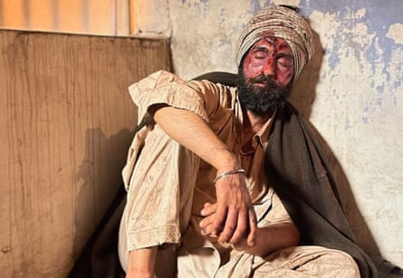 A man with a bruised and bloody face sits and leans against a wall.