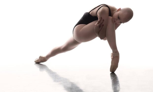 Maggie Kudirka, a 25-year-old ballerina with breast cancer, has had to crowdfund her medical treatment.