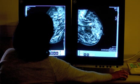 A consultant studies a mammogram. 