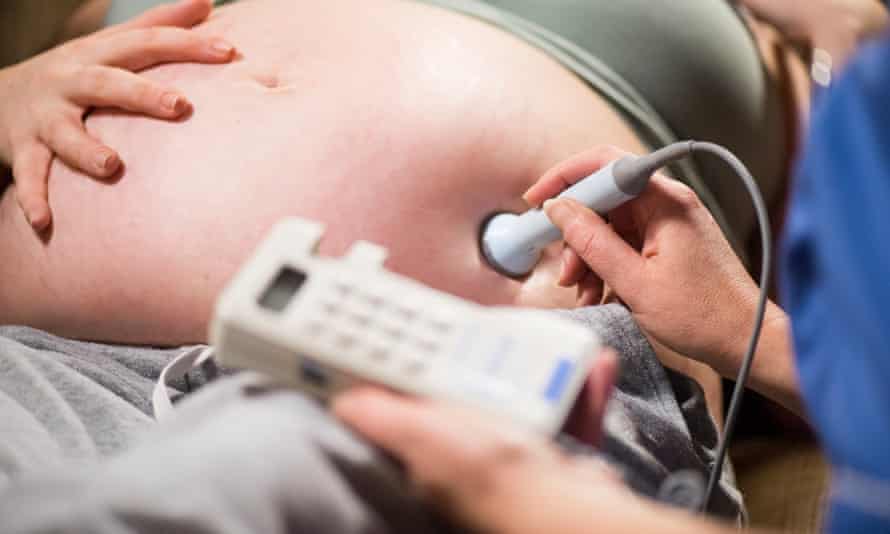 A pregnant woman having an ultrasound scan