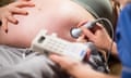 Midwife measuring foetal heart sounds on a pregnant woman's stomach using an audio dopplex