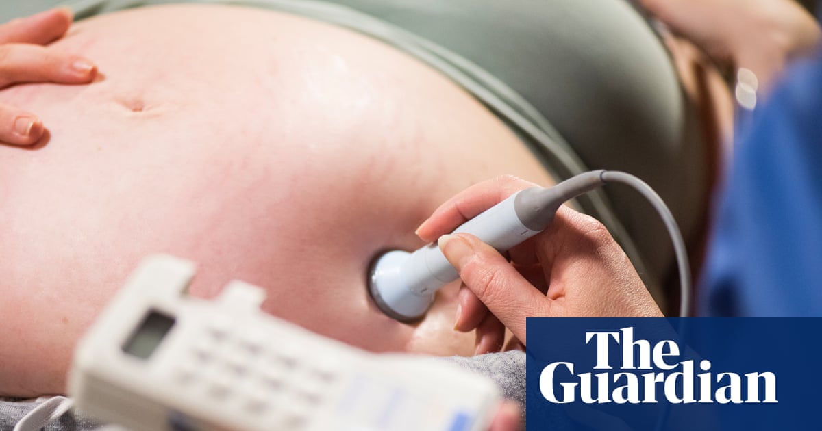 Factors leading to failures in NHS maternity care | Letters