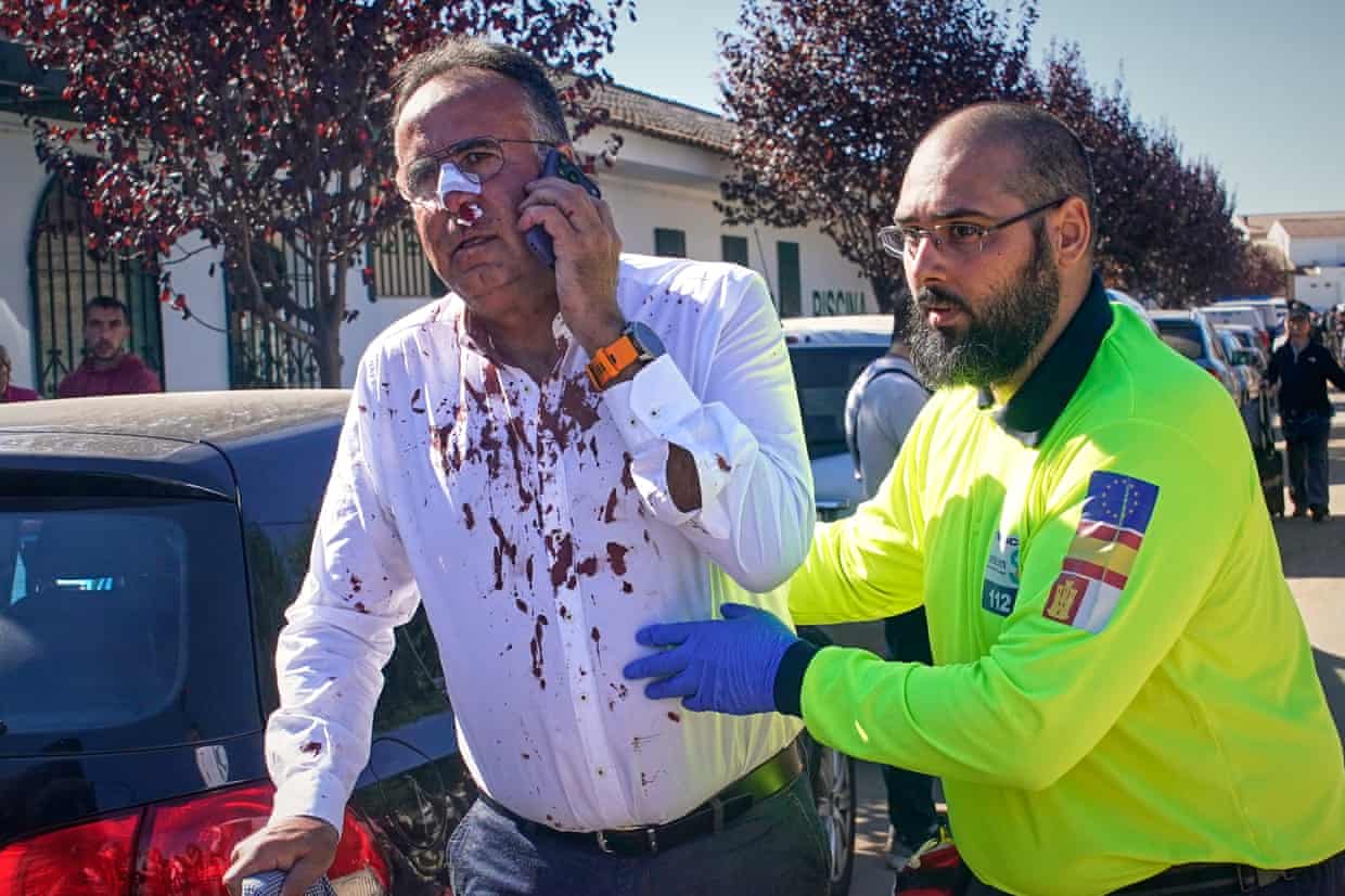 A middle-aged man in a white shirt, covered in blood, with a bandaged across his bloodied nose, speaks on his phone while being aided by a paramedic in a bright yellow jacket.
