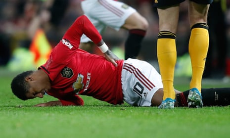 Marcus Rashford suffered a double stress fracture of his back against Wolves