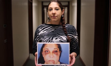 Sabrina, holding a photograph of the injuries inflicted by her former partner, Paul Hopkins, who was sentenced to just two years in jail for the attack.