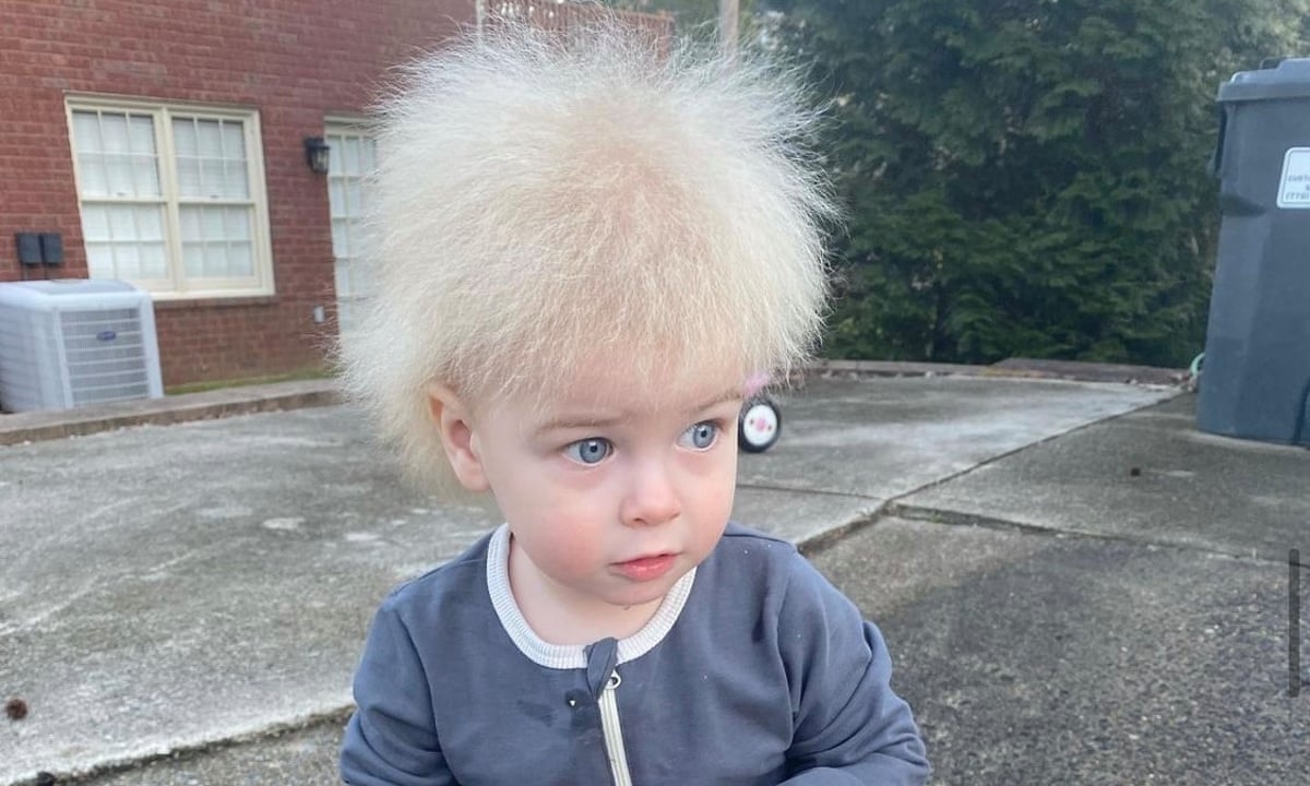 What is a Hair Syndrome?