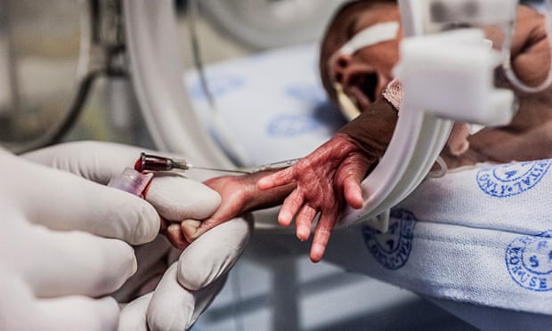 A premature baby is examined in South Africa. 