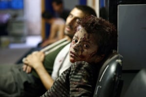 A Syrian boy waits to receive treatment at a makeshift hospital following reported air strikes by government forces in the rebel-held area of Douma.