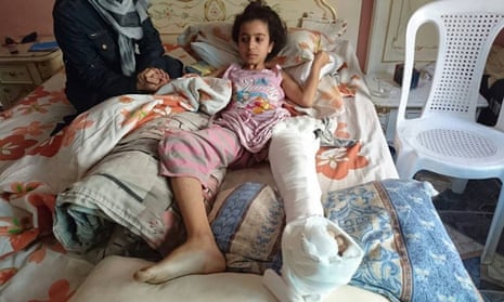 Ghina Ahmad Wadi, who was shot in the leg by a sniper in Madaya, a town west of Damascus, Syria.