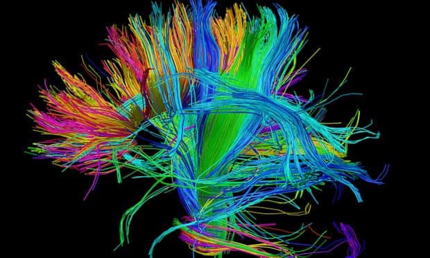 A scan of the bundles of white matter nerve fibres in the brain. 