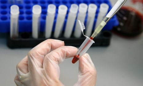 A laboratory technician examines blood samples for HIV and Aids.