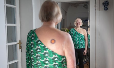 Sarah Browne has a sun tattoo on her upper back, over her skin grafts.