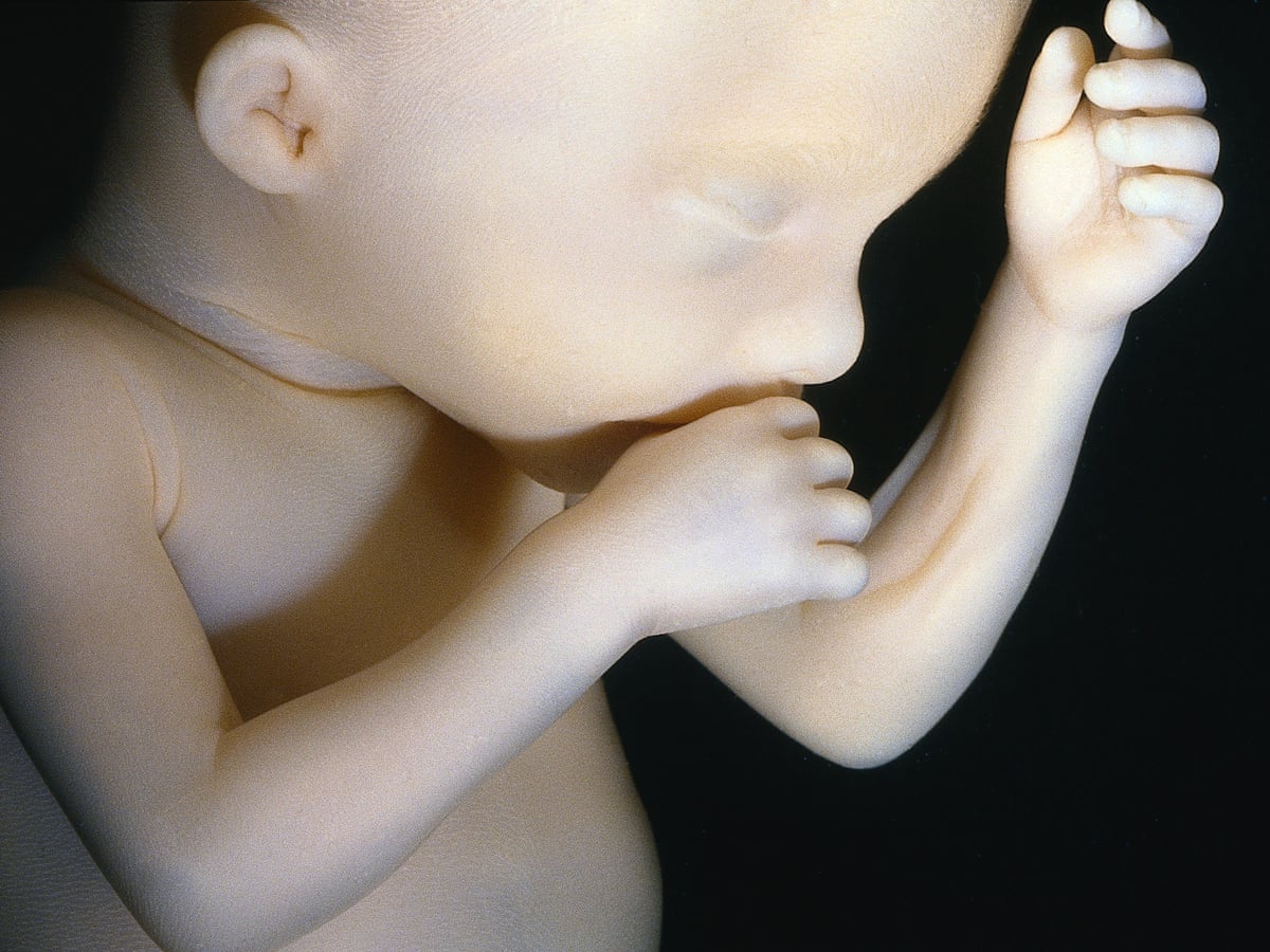 My First Autopsy Was On A 22 Week Foetus Healthcare Network The Guardian My First Autopsy Was On A 22 Week Foetus Healthcare Network The Guardian