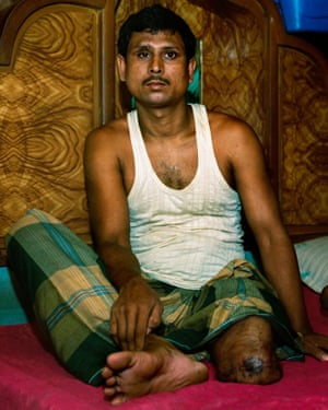 Injured shipbreaker Mohamed Edris