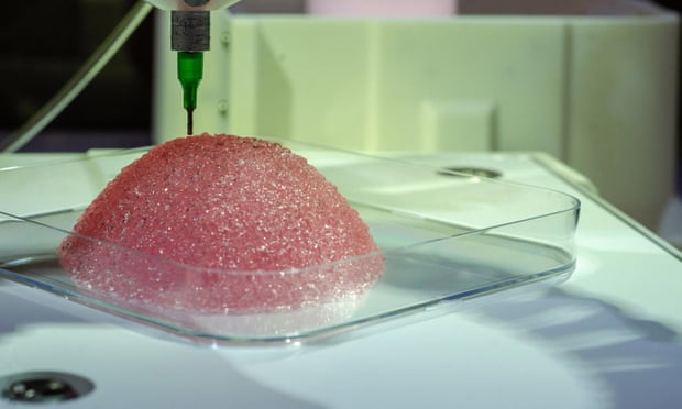 Healshape’s 3D-printed hydrogel implant
