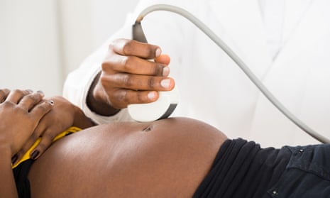 A pregnant woman has an ultrasound scan