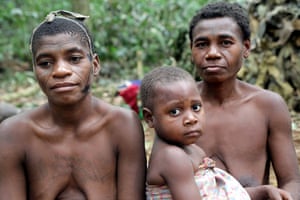A ba'aka woman with her cheek stained with 'medicine' for toothache