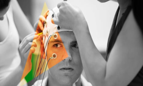 a research subject has electrodes attached for an EEG research study.