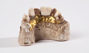 Denture made for King William IV, c1820.