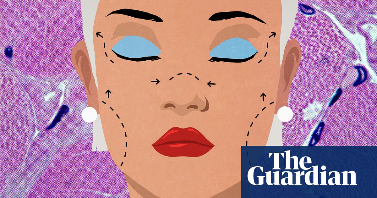 What is a deep plane facelift? Nipping into the buzzy cosmetic procedure