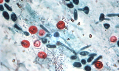Light micrograph of Cryptosporidium sp, a parasite of the digestive and respiratory tracts, causing gastroenteritis (Cryptosporidiosis).