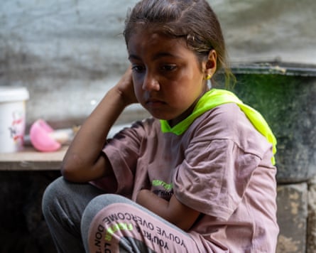 A young woman pinch a missing left-hand sits looking forlorn.