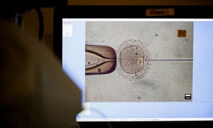 An employee demonstrates the work process before freezing eggs in a fertility research lab at Cha fertility centre in Bundang, South Korea. Photograph: Heo Ran for Reuters
