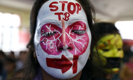 A woman with her face painted with lungs and the words 'stop TB'.