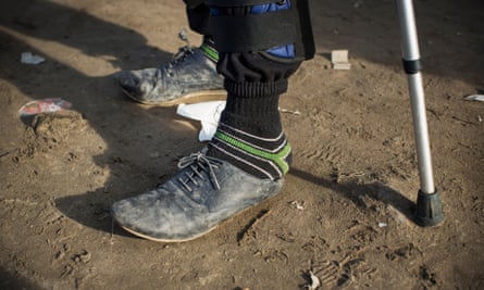 A man wearing ill-fitting shoes