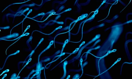 Research suggests that sperm counts have dropped by half in the last 50 years or so and that a higher percentage are poor swimmers.