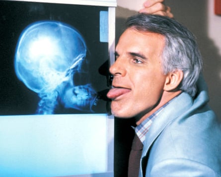 Steve Martin stars in The Man With Two Brains.