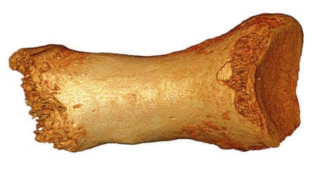 Dorsal view of the Neanderthal woman’s toe bone.