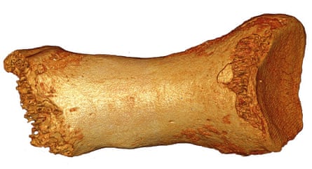 Neanderthal-Denisovan toe bone