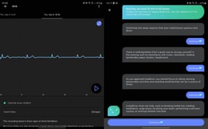 Withings ScanWatch review