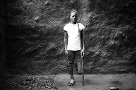 Rogério Lucas, 14, lost his leg as a baby