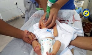 A rescue worker treating a baby allegedly affected by a chlorine gas attack in Saraqeb.