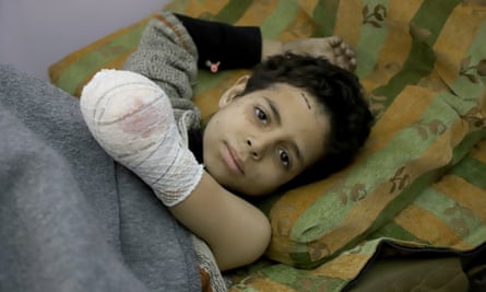 A boy injured boy by bombing in Damascus, Syria