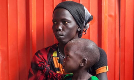 A woman and her malnourished child wait to receive treatment at the Leer hospital in South Sudan.