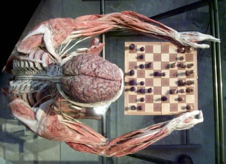 A preserved human body with its brain and musculature exposed, posed at a chessboard and viewed from directly above