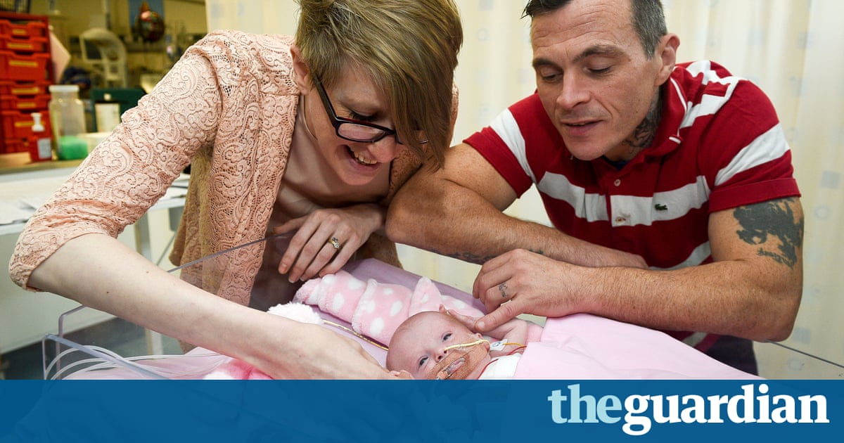 Baby girl survives with heart outside her body at birth, in UK first 2