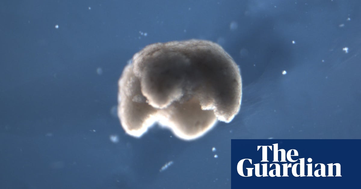 Scientists use stem cells from frogs to build first living robots