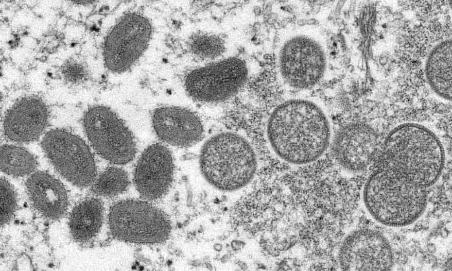 An electron microscope image made available by the Centers for Disease Control and Prevention shows mature, oval-shaped monkeypox virions.