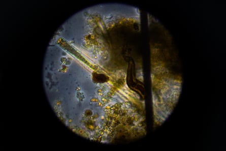 Bacteria seen under a microscope