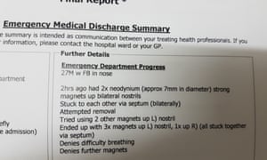 Hospital record:
        Daniel Reardons discharge report after presenting at hospital
        with magnets stuck up his nose.