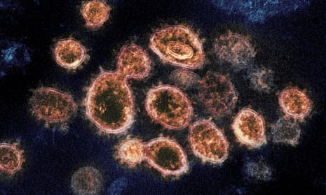 An electron microscope image shows the virus that causes Covid-19