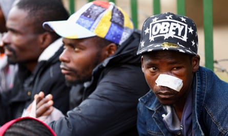 Three men, one with a bandaged eye