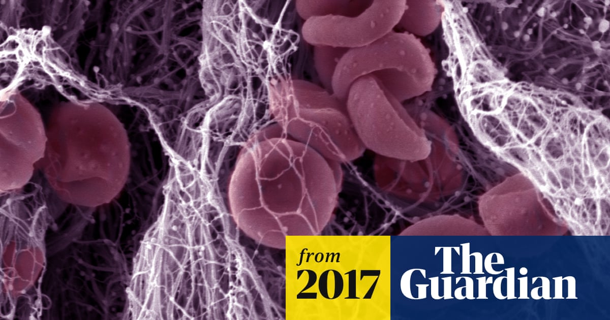 Download High Blood Platelet Count As Good A Cancer Predictor As A Lump In Free HD Wallpaper High Blood Platelet Count As Good A Cancer Predictor As A Lump In For Android Free