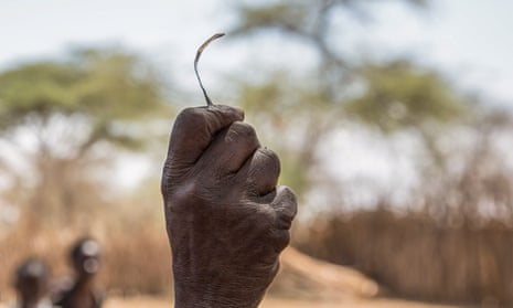 A woman holds a tool used for FGM